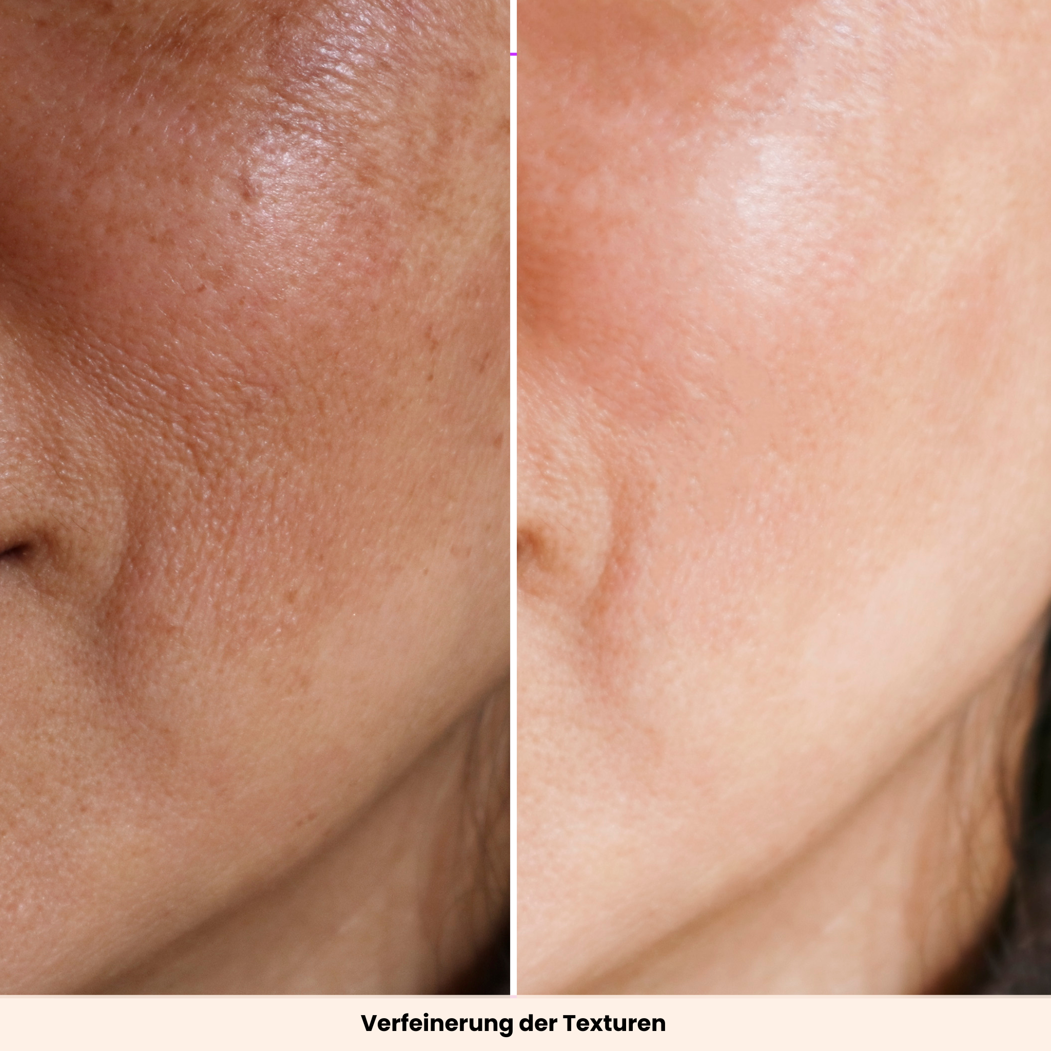 EMS GuaSha | Beauty Tool mit Lichttherapie