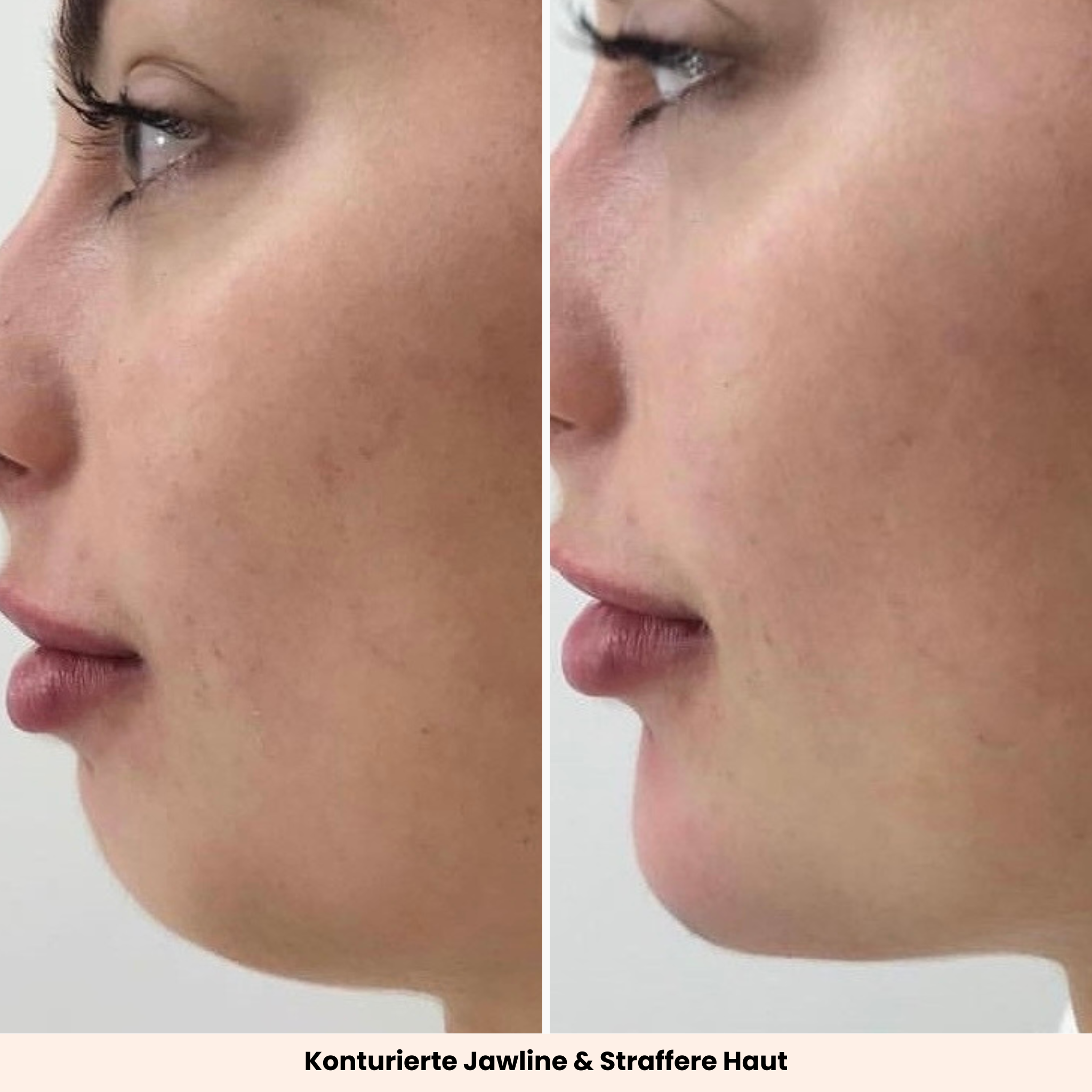 EMS GuaSha | Beauty Tool mit Lichttherapie