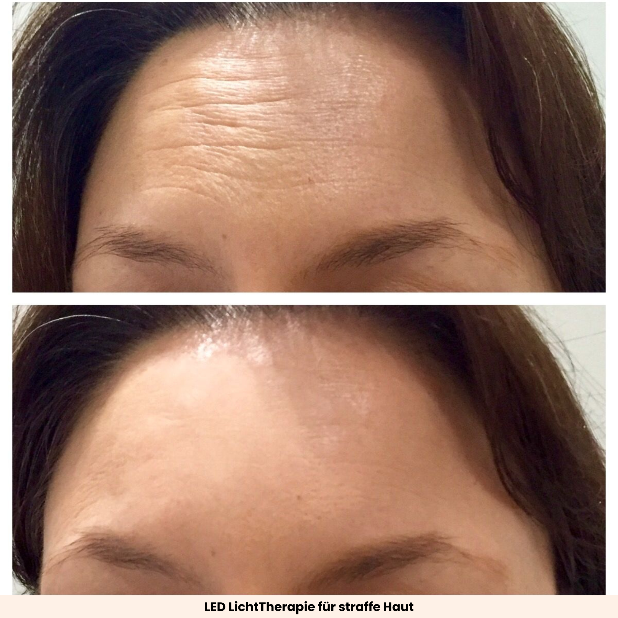 EMS GuaSha | Beauty Tool mit Lichttherapie