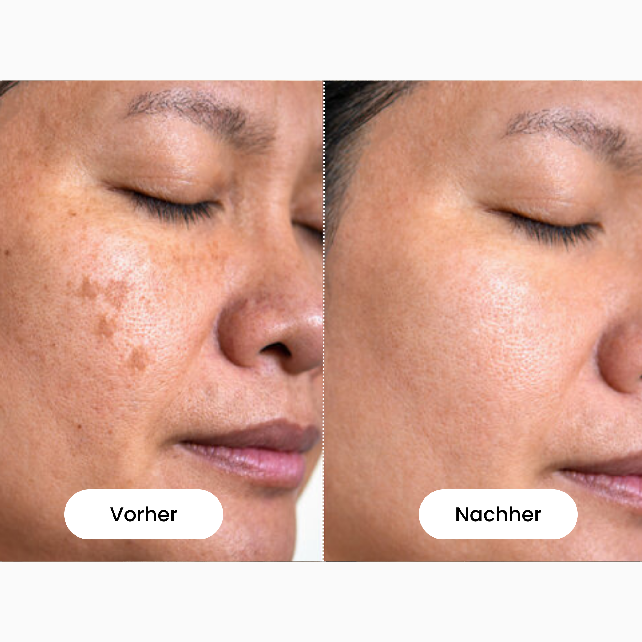 #1 LED Face Mask